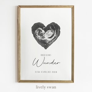 Póster personalizado de imagen de ecografía, anuncio de embarazo, póster para habitación de bebé, decoración
