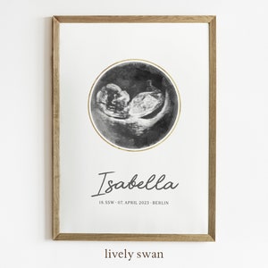 Póster personalizado de imagen de ecografía, anuncio de embarazo, póster para habitación de bebé, decoración