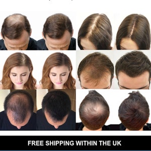 Hair Loss Building Fibres for thinning, balding, receding hairline - 0.98 oz / 28g Bottle