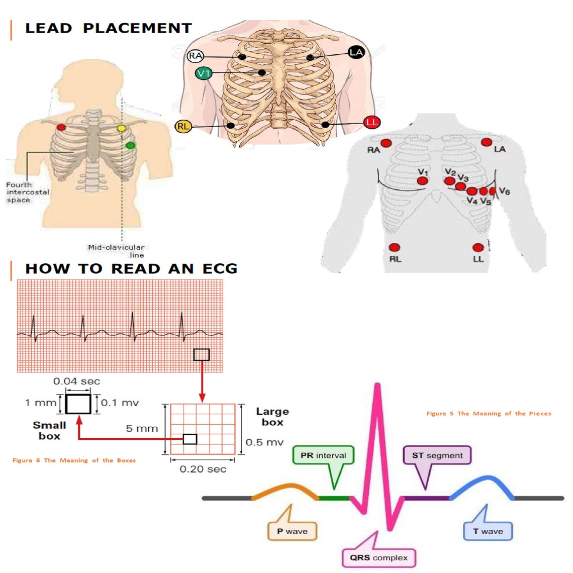 Advanced ECG for Advanced Providers Like MD, NP, Pa and Other 8 Pages ...