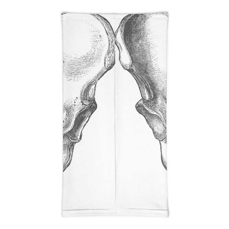 Gynecoid pelvis image