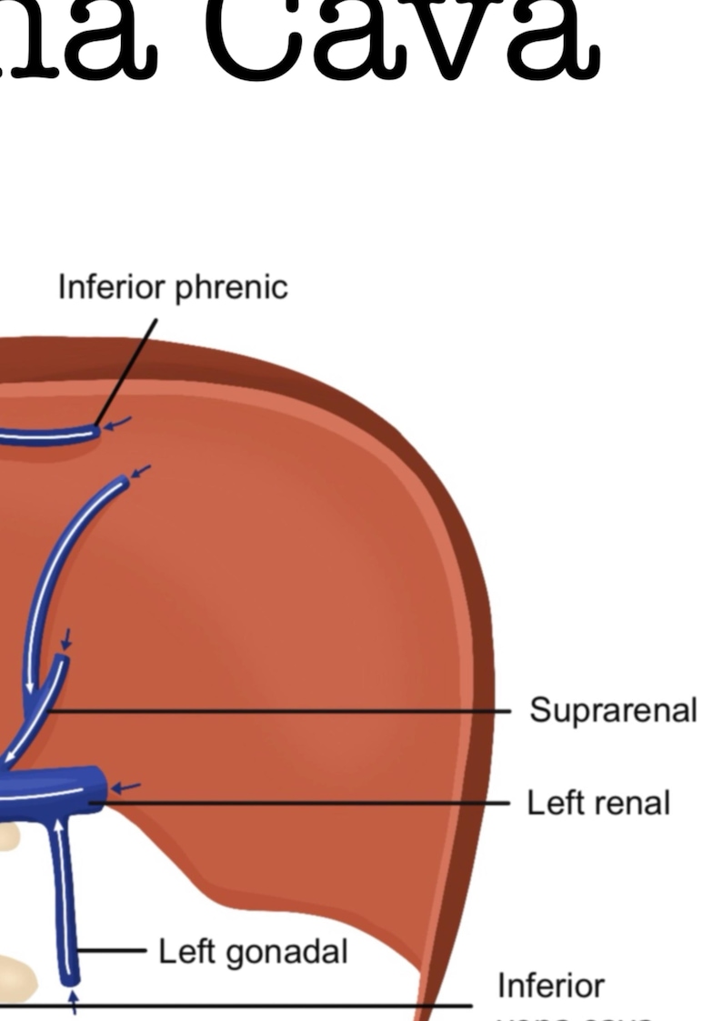 Inferior Vena Cava Review Guide | Labeled | Venous Anatomy Study Sheet ...
