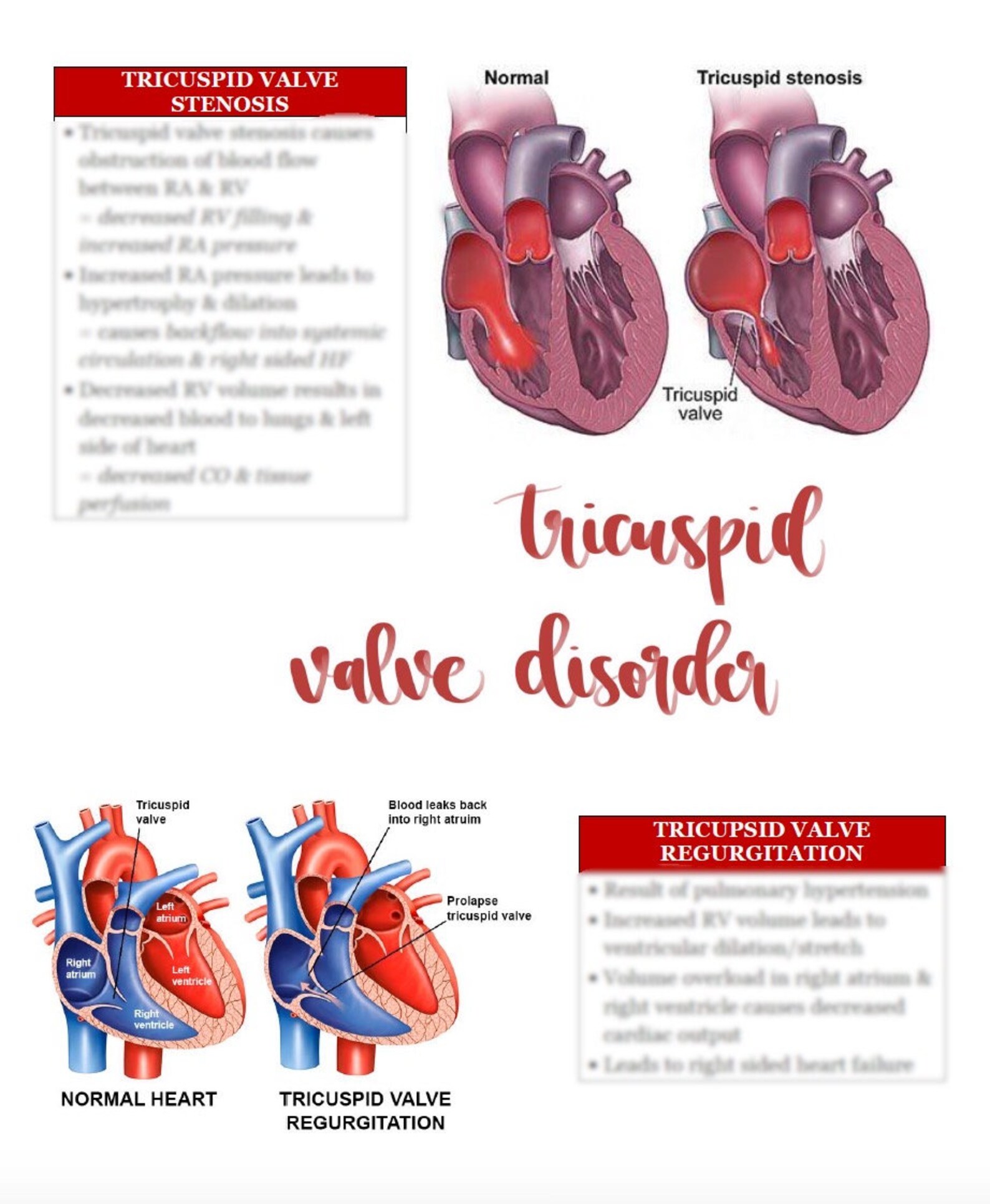 Cardiac Valve Disorders Nursing Study Guide Etsy