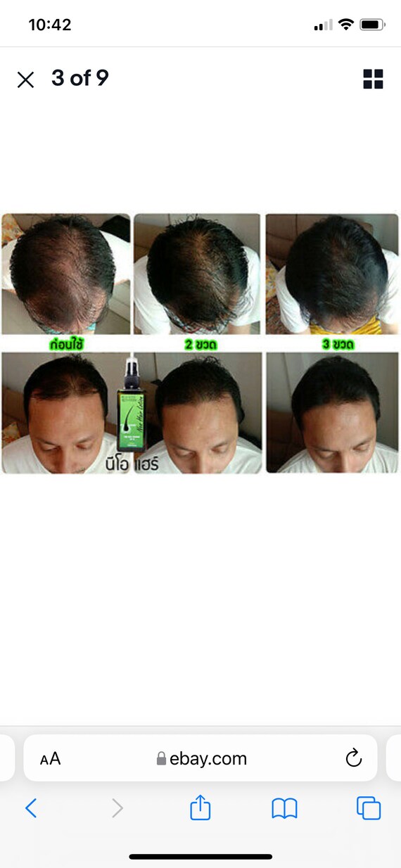 3 Bottles. Green Wealth Neo Neo Hair Lotion Root Hair Loss - Etsy Australia 3 Bottles. Green Wealth Neo Neo Hair Lotion Root Hair Loss - Etsy Australia