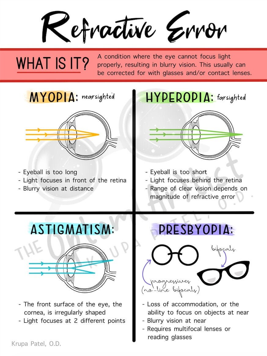 Refractive Error Poster Optometry Poster Optometry Etsy
