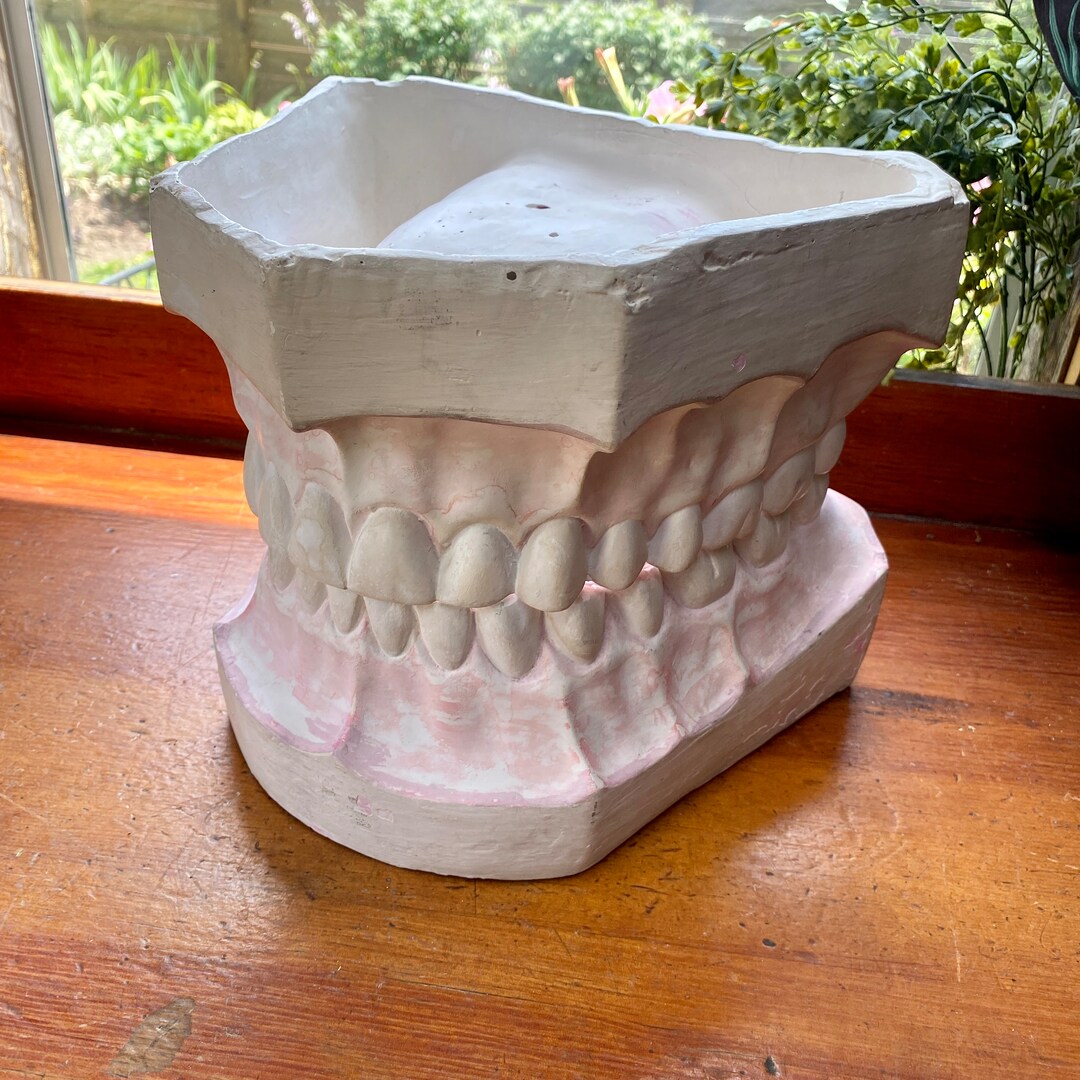 Teeth Impression Sculpture Oversized Medical Plaster Cast Dentist Tooth