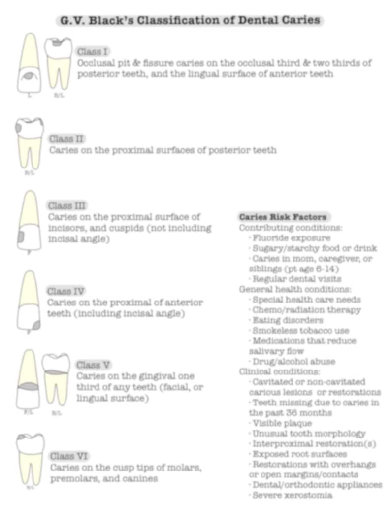 Dental Caries, GV Black, Caries Risk, Dental Hygiene, Hygienist
