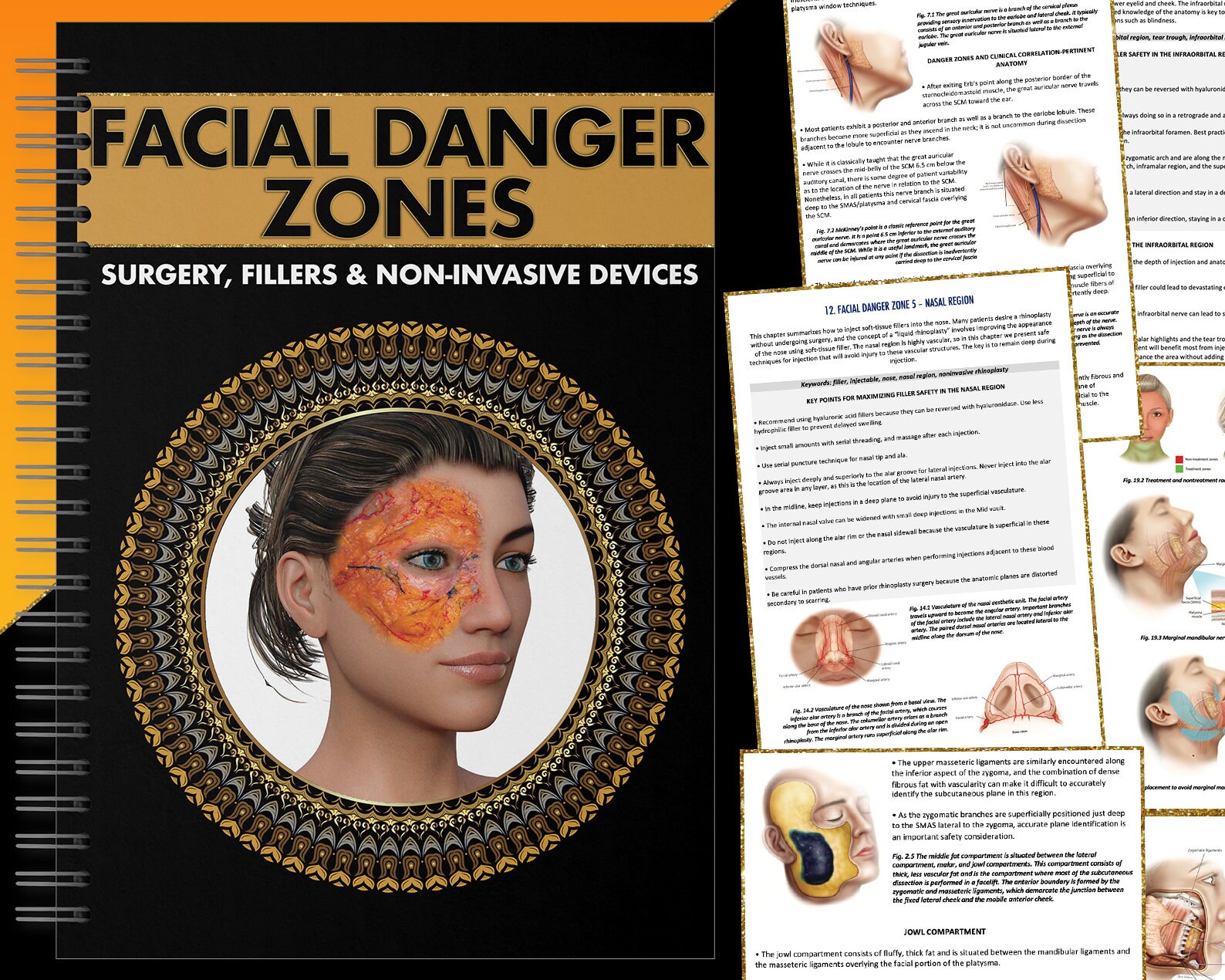 Facial Danger Zones Fillers Neuromodulator Surgery Lasers Etsy