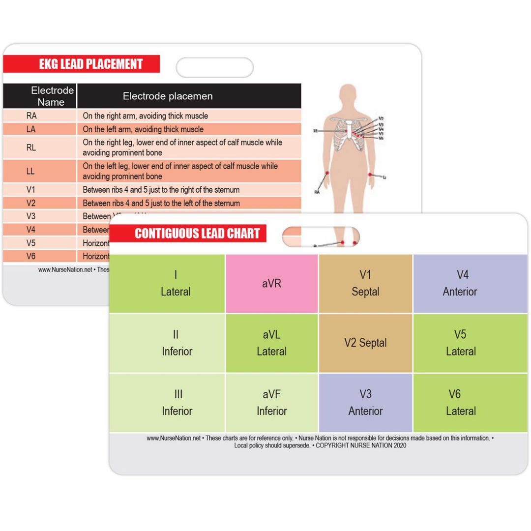 STEMI 12 Lead Reference and 12 Lead EKG (ECG) Placement Reference ...
