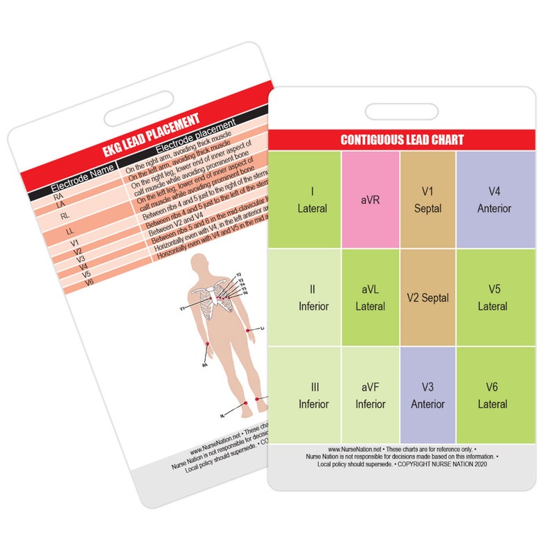 STEMI 12 Lead Reference and 12 Lead EKG ECG Placement - Etsy Canada
