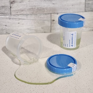 Puede incluir: Un recipiente de muestra de plástico transparente con una tapa azul y un líquido derramado. El recipiente está etiquetado como "BIOHAZARDOUS" y "STERILE". El líquido derramado es de color amarillo verdoso claro. Otro recipiente con tapa azul está en posición vertical.