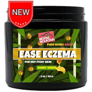 Eczema / Psoriasis Honey Ointment Salve Natural Dermatitis Itch Treatment