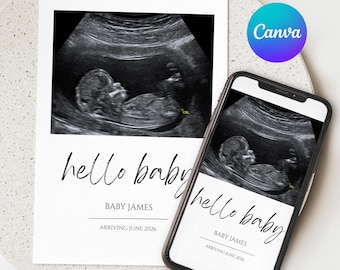 Editable Hello Baby Ultrasound Birth Announcement, New Baby, Announcement Template, Canva Editable Template, Instant Download Announcement,