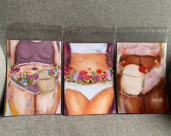 Ostomy Art Prints (Set of 3): Floral Stoma Art, Ileostomy, Colostomy