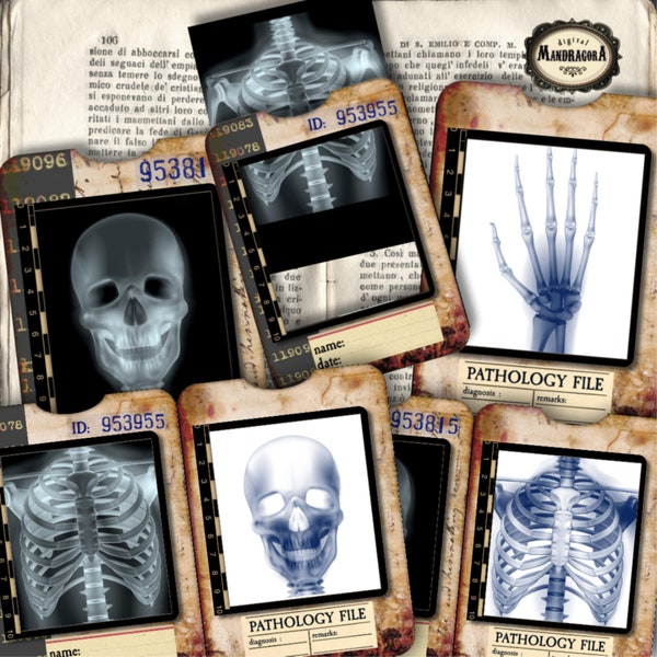 X-ray slides with tray, human skeleton, vintage medical pathology cards, junk journal, x-ray, medical slides, röntgen, digital download