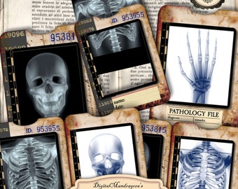 X-ray slides with tray, human skeleton, vintage medical pathology cards, junk journal, x-ray, medical slides, röntgen, digital download