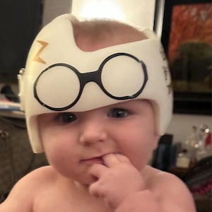 May include: A white cranial orthosis helmet featuring a black graphic of round glasses on the front and a gold lightning bolt symbol on the side. The helmet is designed to fit the head and has a cutout section at the top for the crown area.