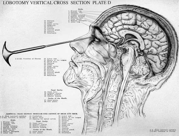 AUTHENTIC Lobotomy Orbitoclast & Hammer Clone Set READ DESCRIPTION