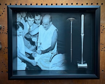 BESTSELLER! Lobotomy Shadowbox Display Large