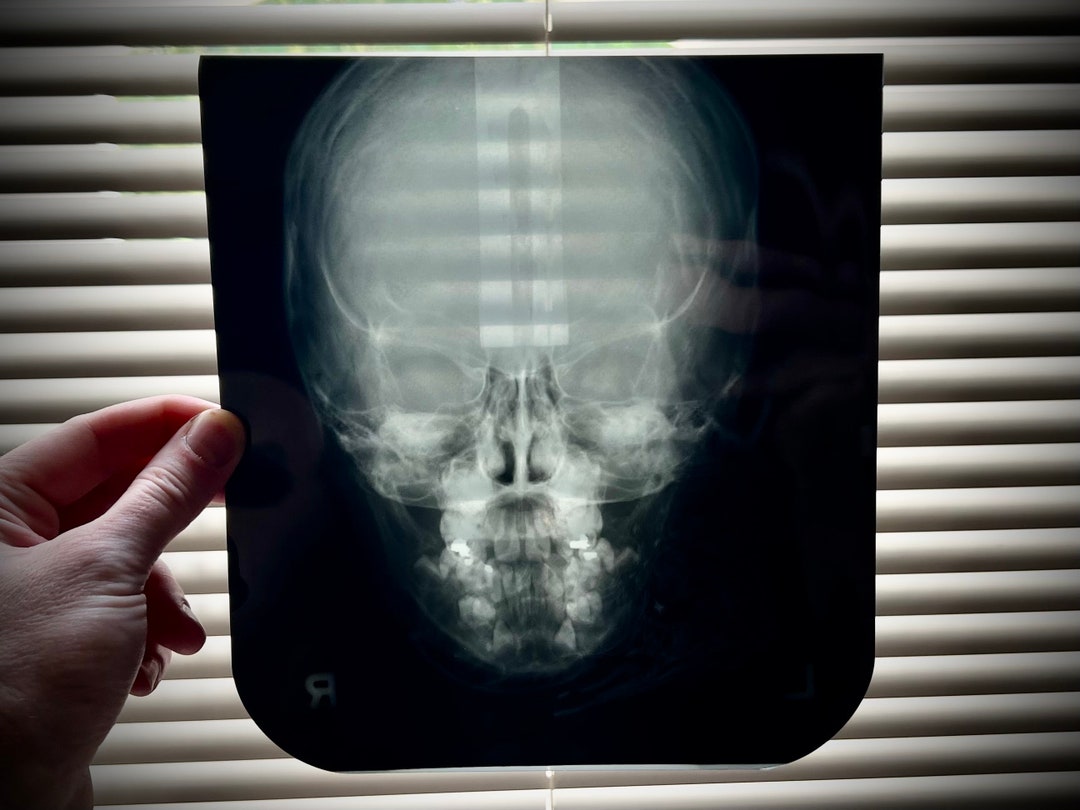Menschlicher Schädel Xray XRay Etsy.de