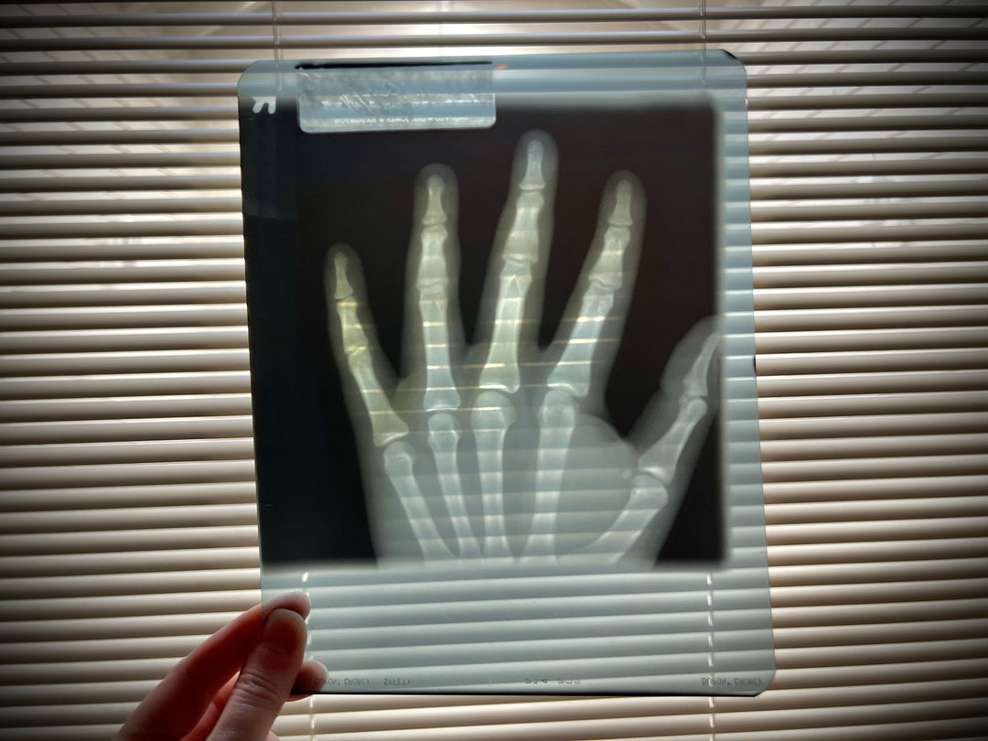 Human Hand Xray Xray Etsy