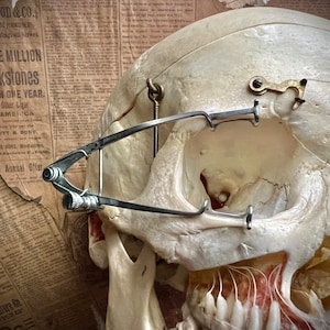 Unique Eye Speculum