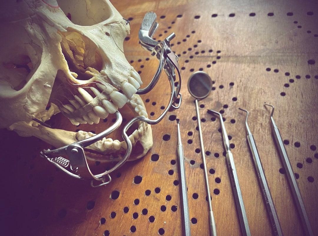 Bâillon ouvre-bouche bdsm en forme de lèvres