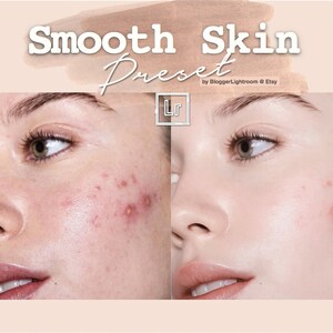 MOBILE Lightroom Preset, Smooth Skin, Skin Smoothing, Instagram Preset, Blogger iPhone Preset, DNG File, Influencer Preset, Good Complexsion image 1