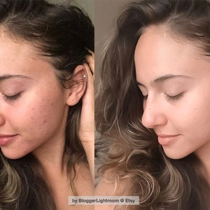 MOBILE Lightroom Preset, Smooth Skin, Skin Smoothing, Instagram Preset, Blogger iPhone Preset, DNG File, Influencer Preset, Good Complexsion image 2