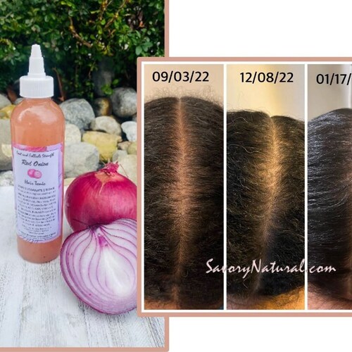 Red Onion Hair Tonic for Root & Follicle Strength Stimulate - Etsy Red Onion Hair Tonic for Root & Follicle Strength Stimulate - Etsy