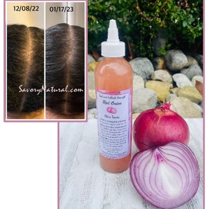 Red Onion Hair Root Follicle Strength Regrow Thinning Hair Stimulate Growth and repair breaking hair STOP Shedding breaking damage | ALL NEW