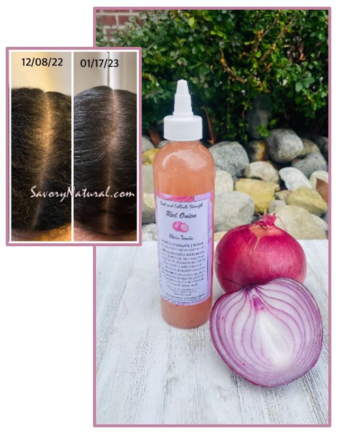 Red Onion Follicle & Root Strength Regrow Thinning Hair Stimulate