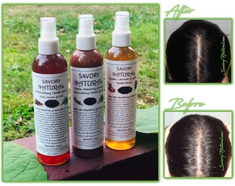 Rapid Growth Spray Indian Herbal Ayurvedic Assam Roots Follicles Stimulant Longer Stronger Thicker Hair w/ Rosemary Clove Mint NATURAL VEGAN