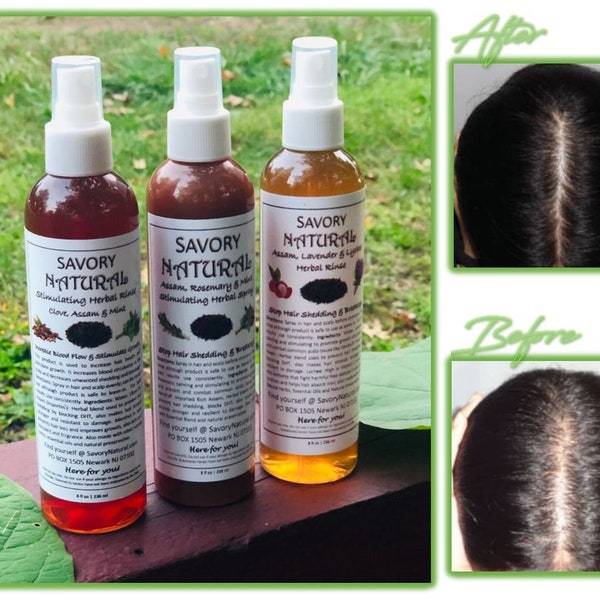 Rapid Growth Spray Indian Herbal Ayurvedic Assam Roots Follicles Stimulant Longer Stronger Thicker Hair w/ Rosemary Clove Mint NATURAL VEGAN