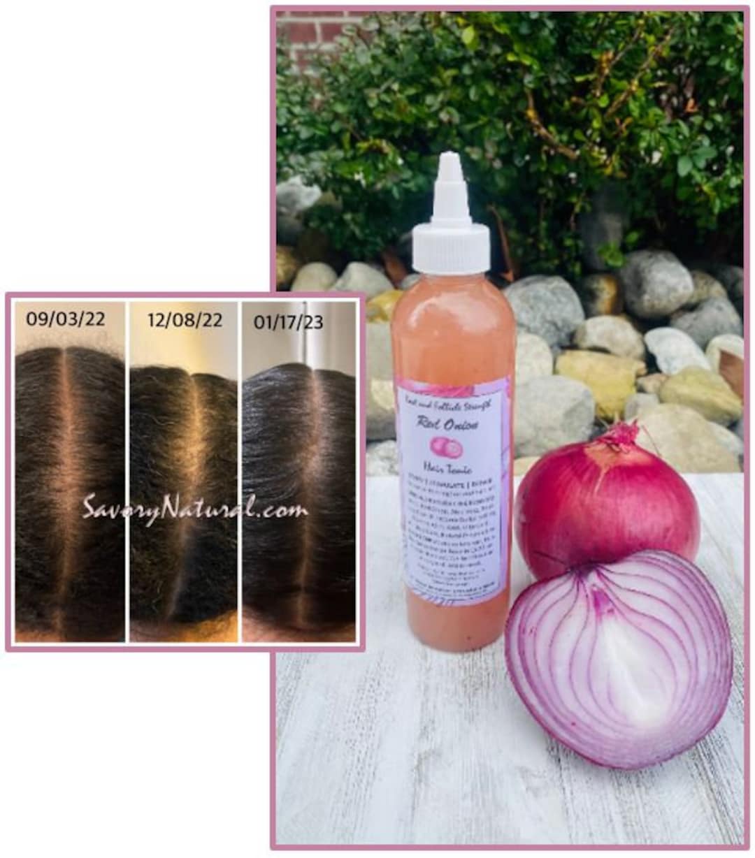 Red Onion Hair Root Follicle Strength Regrow Thinning Hair Stimulate