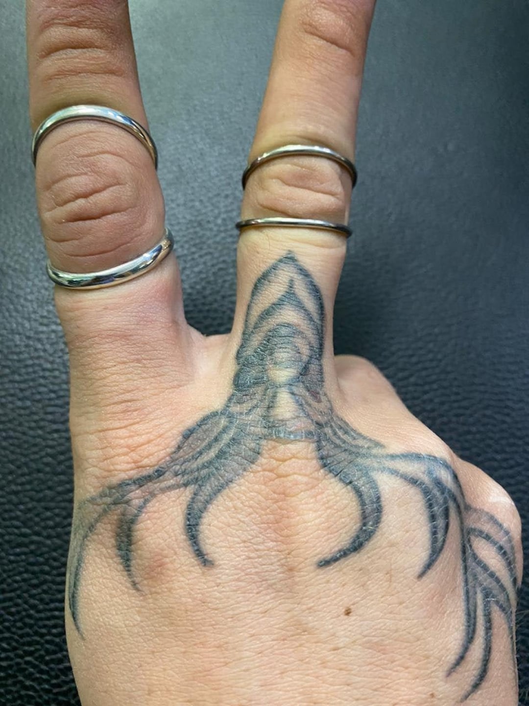 Arthritis Finger Ring,splint Ring,trigger Finger Ring,knuckle Ring