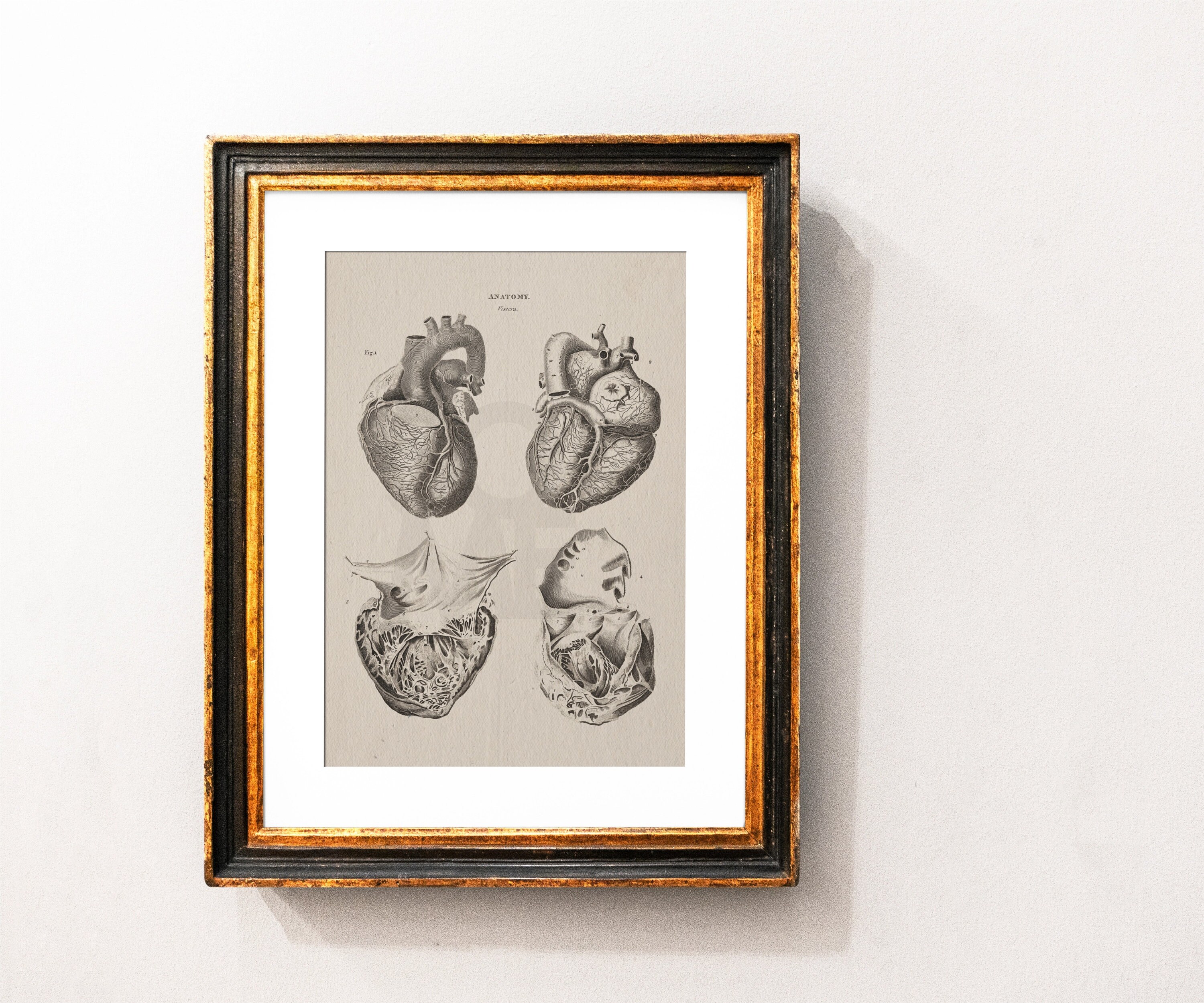 Human Heart Print . Anatomy Wall Art . Cardiothoracic Surgeon Gift ...