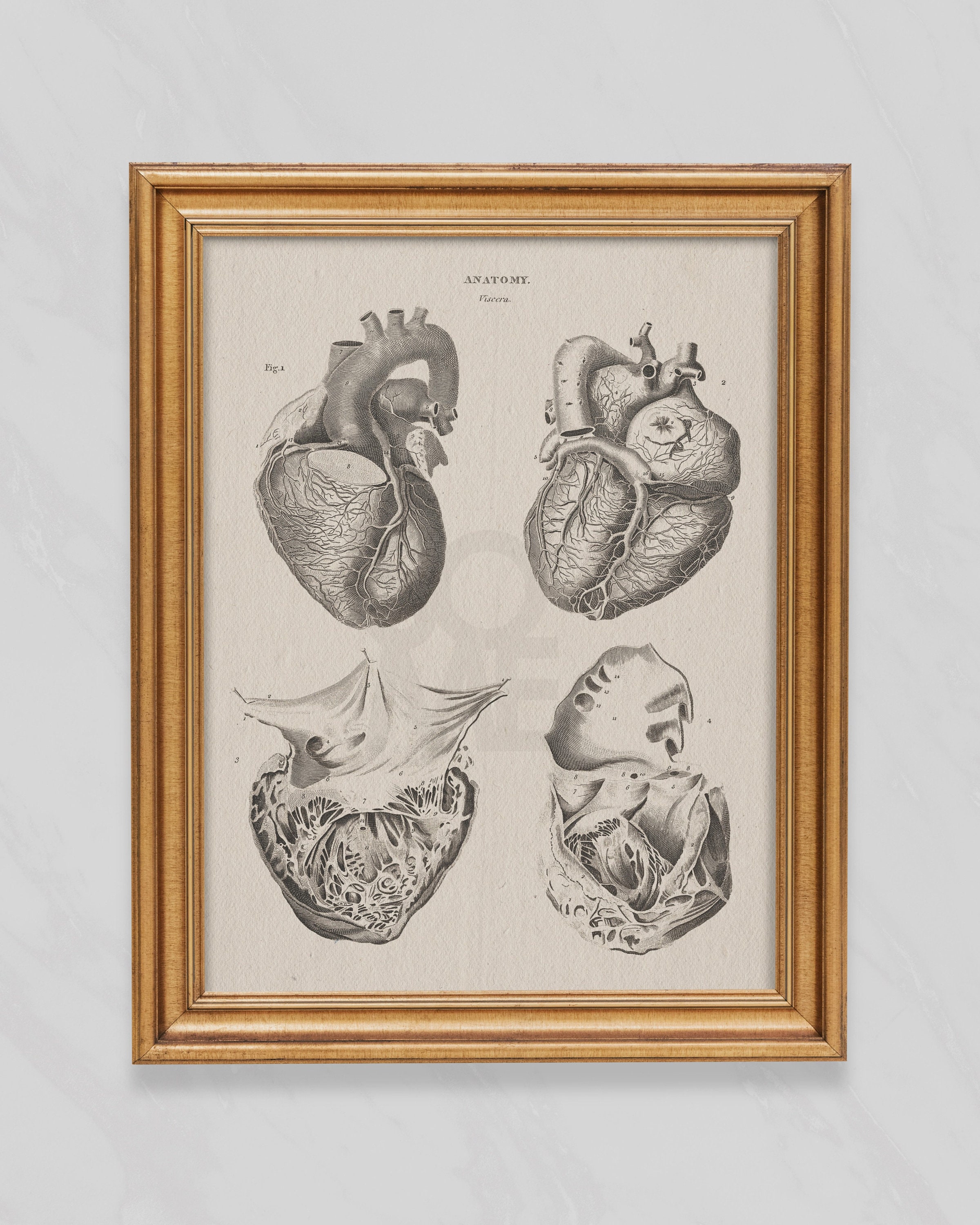 Human Heart Print . Anatomy Wall Art . Cardiothoracic Surgeon Gift ...