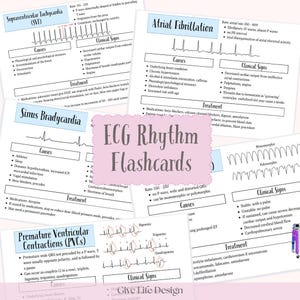 ECG Rhythm Flashcards, EKG flashcards, ekg study guide, ecg study guide, nursing school study guide, nclex flashcards, nclex study guide