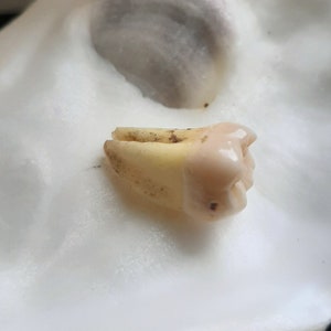 De tand afbeelding 1