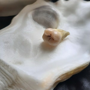 De tand afbeelding 3