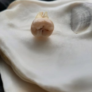 De tand afbeelding 2
