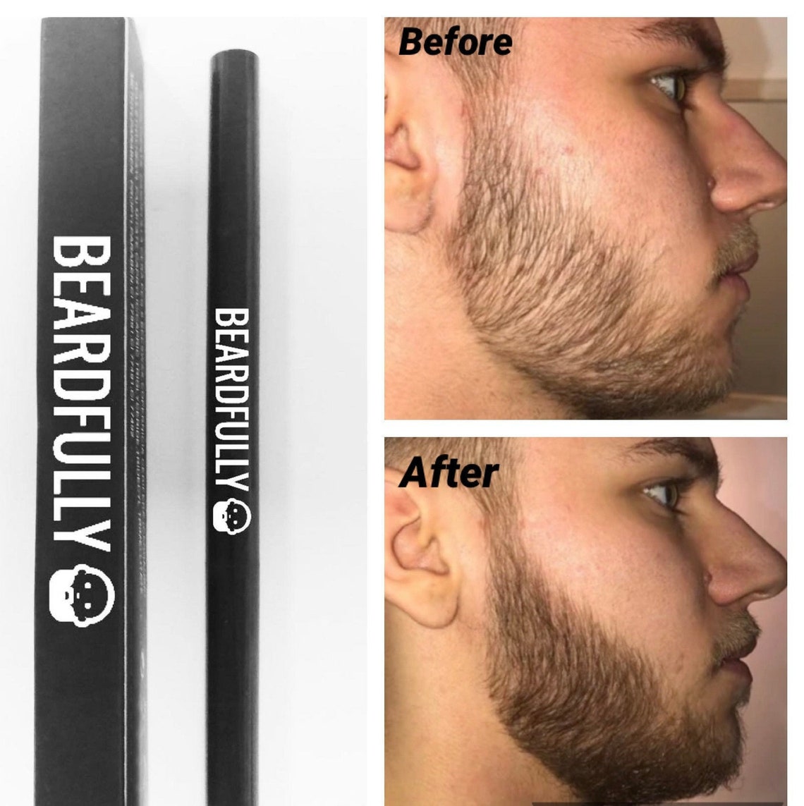 Beardfully Beard Filler Pen Fill Gaps / Thin / Patchy Beard Etsy