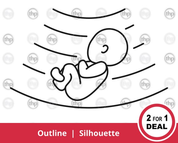 Download Baby Ultrasound Svg Baby Svg Pregnancy Svg Sonogram Svg Etsy