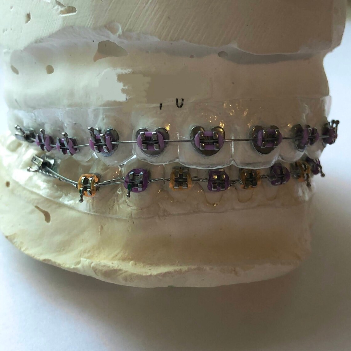 Heart Shape CUSTOM Fake Braces Prop Retainer with Brackets Etsy