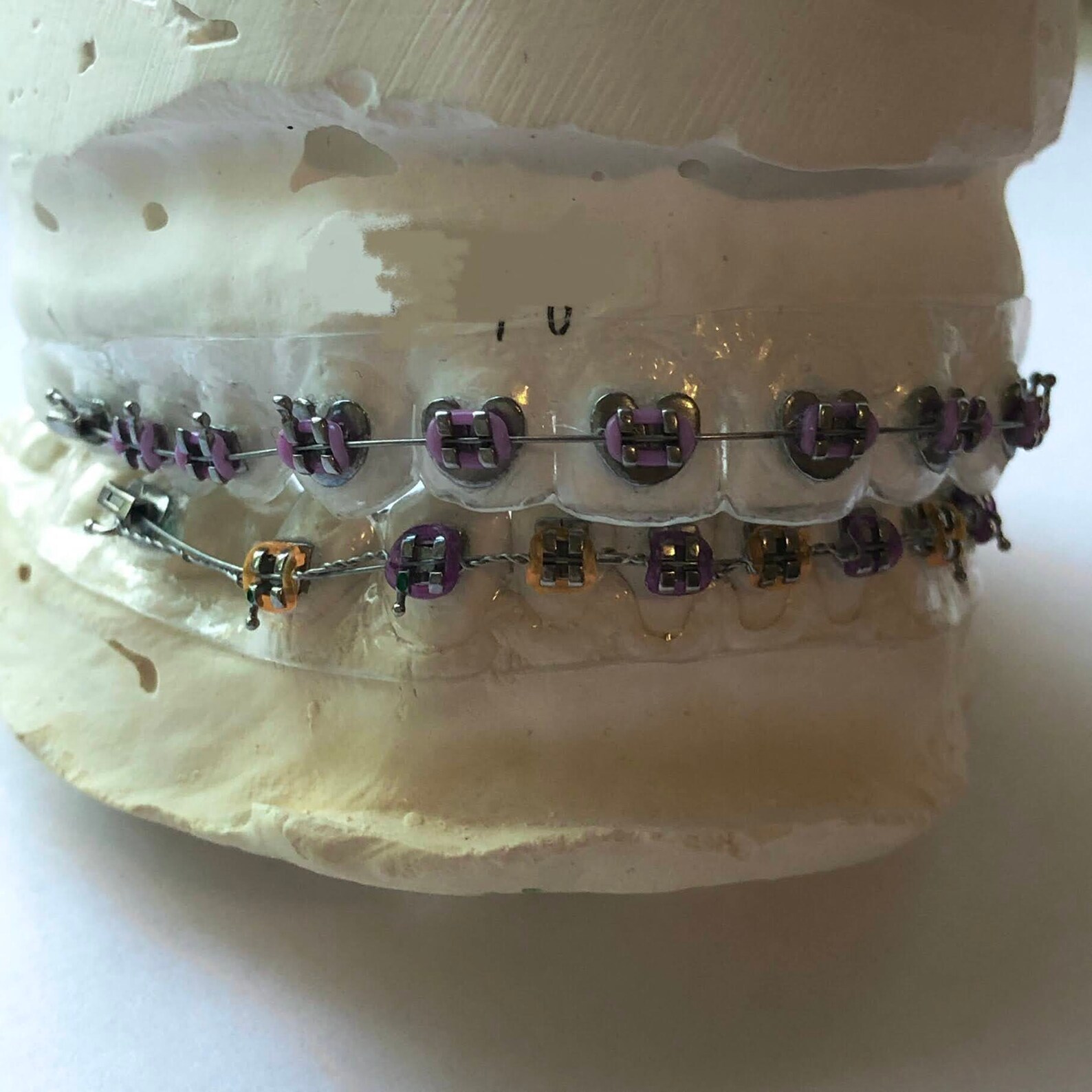 Heart Shape CUSTOM Fake Braces Prop Retainer with Brackets Etsy