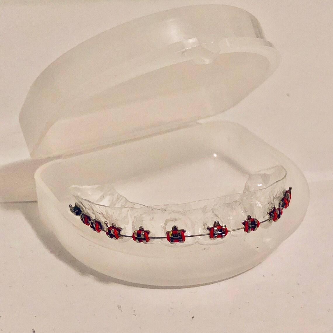 Star Shape CUSTOM Fake Braces Prop Retainer with Brackets Etsy