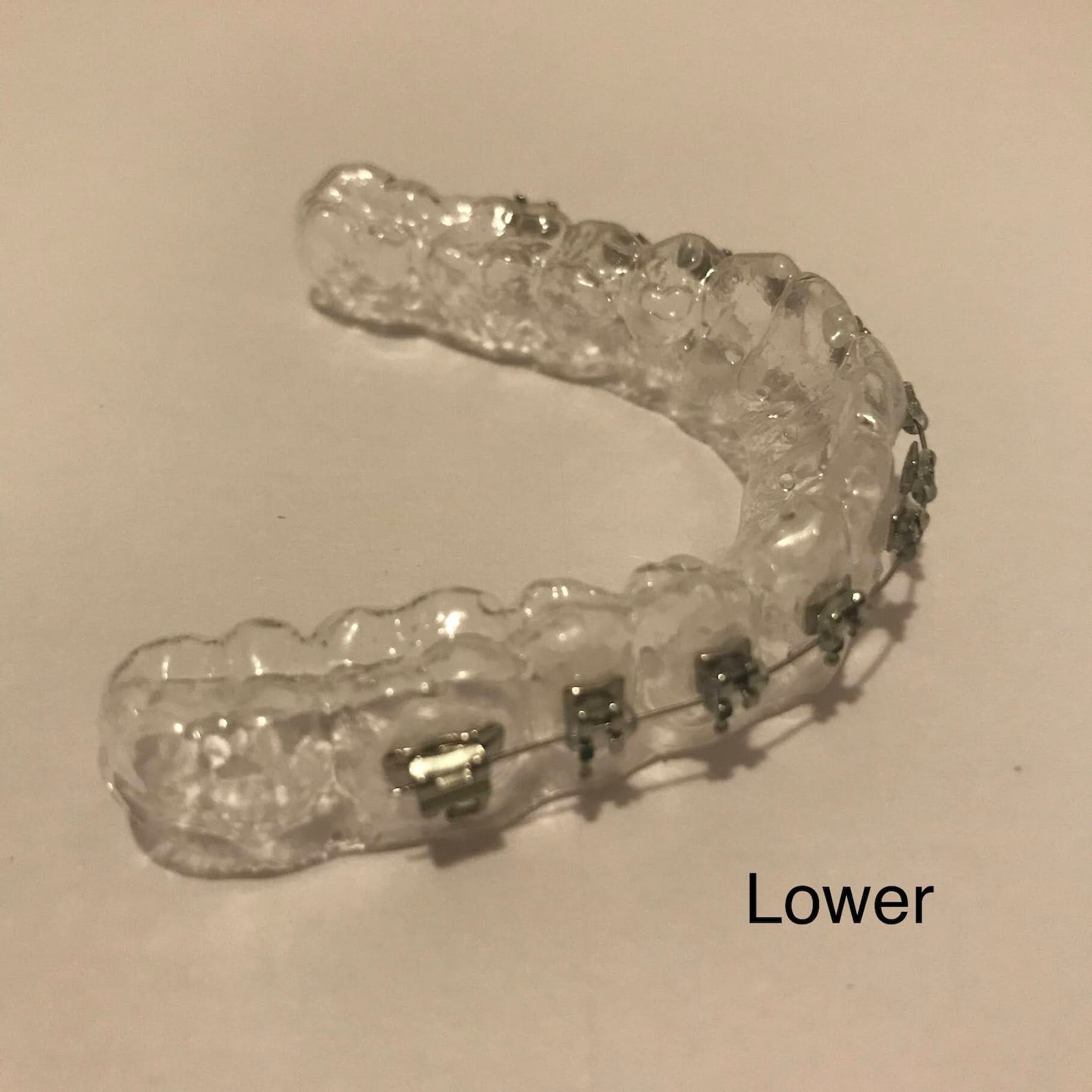 CUSTOM MADE Fake Braces Prop Retainer With Brackets Costume Etsy