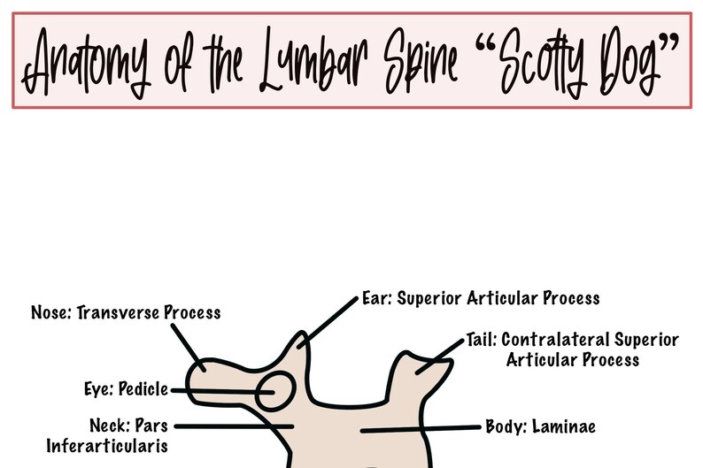 Anatomy of the Lumbar Spine scotty Dog Etsy