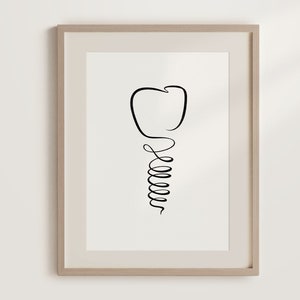 Tooth Implant Printable Wall Art, Minimalist Dental Art Print, Dentist Art Gift, Orthodontist Line Painting, One Line Medical Illustration.
